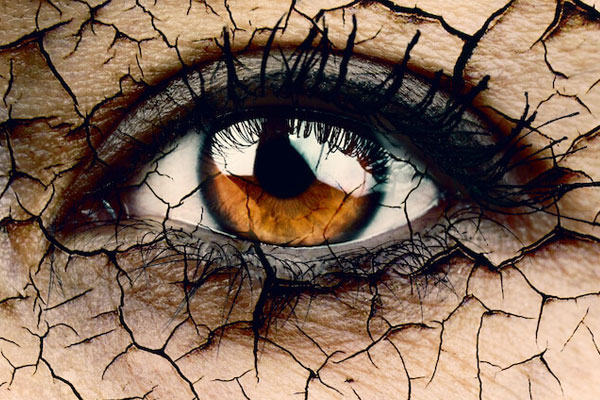 Darstellung trockene Augen